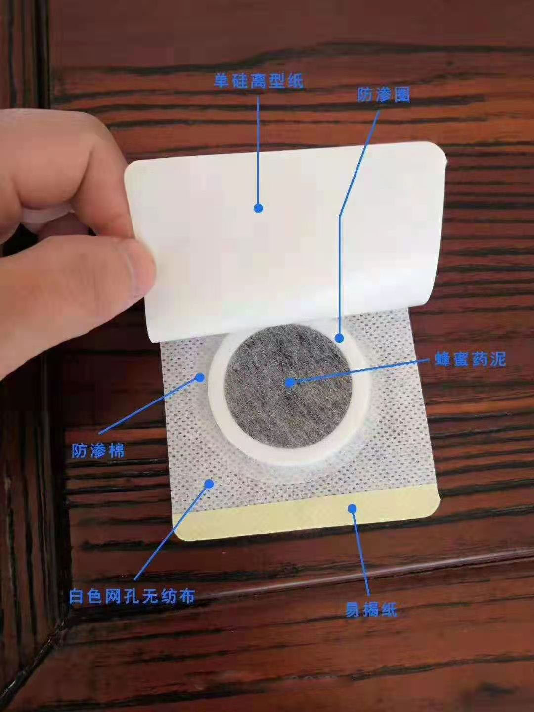 穴位壓力刺激貼。